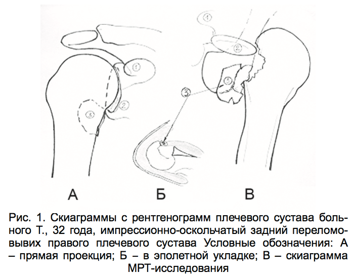 Рис. 1. Скиаграммы