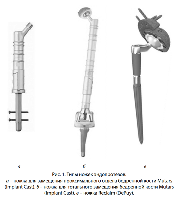 Рис. 1. Типы ножек эндопротезов