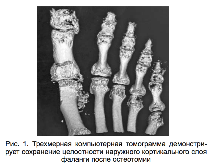 Рис. 1. Трехмерная компьютерная томограмма