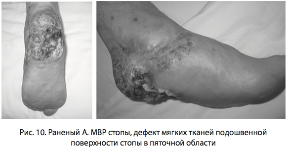 Рис. 10. Раненый А. МВР