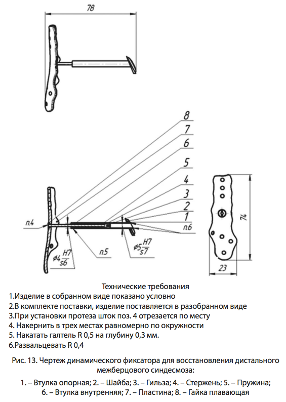 Рис. 13. Чертеж динамического фиксатора