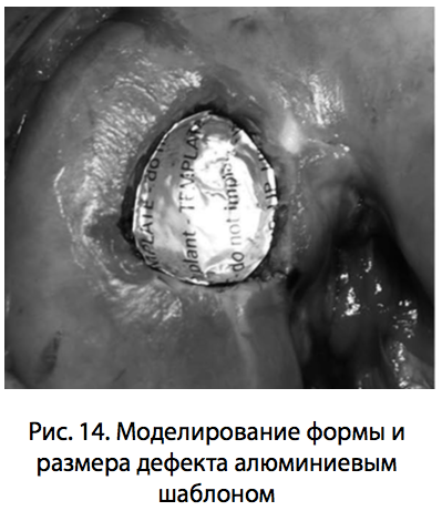 Рис. 14. Моделирование формы и размера дефекта