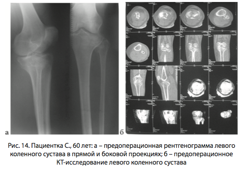 Рис. 14. Пациентка С., 60 лет