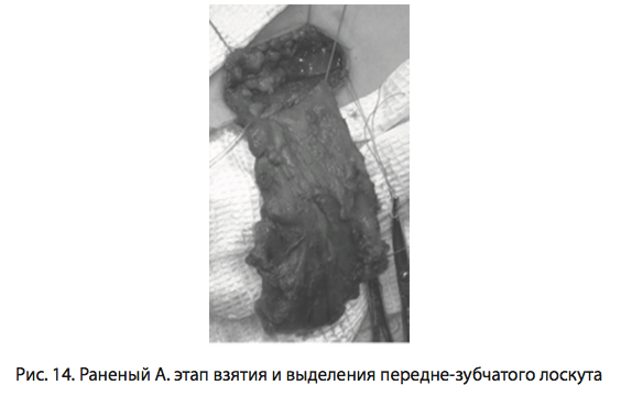 Рис. 14. Раненый А. этап взятия