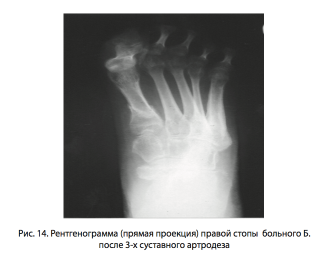 Рис. 14. Рентгенограмма