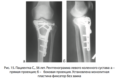 Рис. 15. Пациентка С., 56 лет