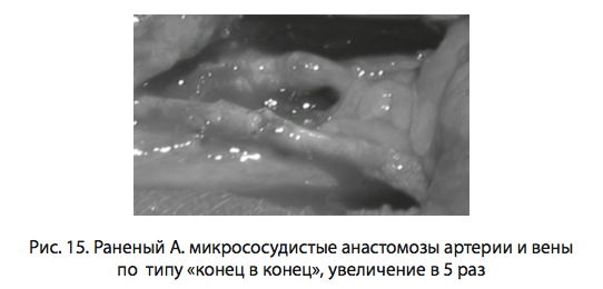 Рис. 15. Раненый А. микрососудистые анастомозы