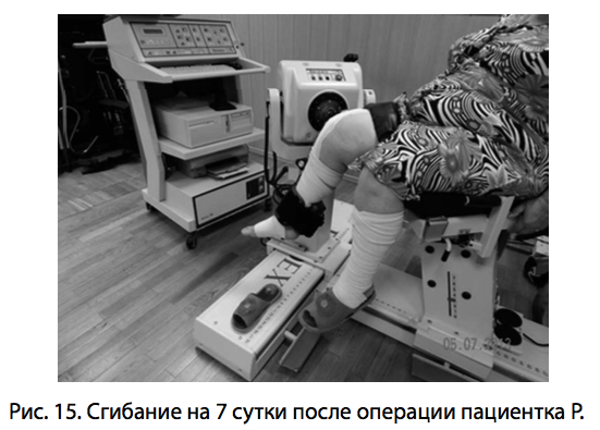 Рис. 15. Сгибание на 7 сутки после
