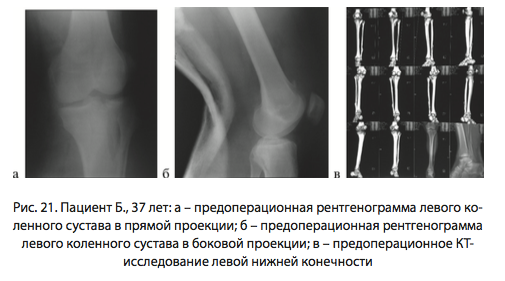 Рис. 21. Пациент Б., 37 лет