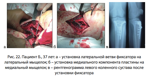 Рис. 22. Пациент Б., 37 лет
