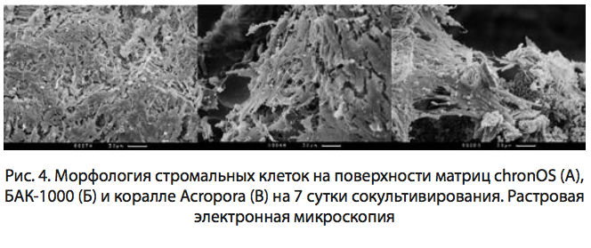 Рис. 4. Морфология стромальных клеток