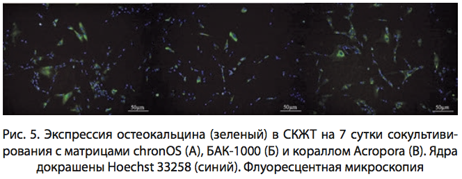 Рис. 5. Экспрессия остеокальцина