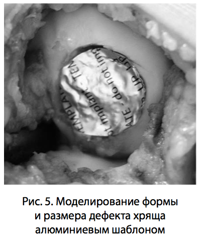 Рис. 5. Моделирование формы и размера дефекта