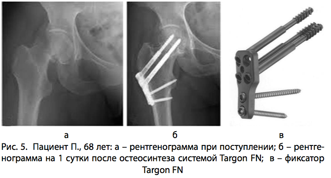 Рис. 5. Пациент П.