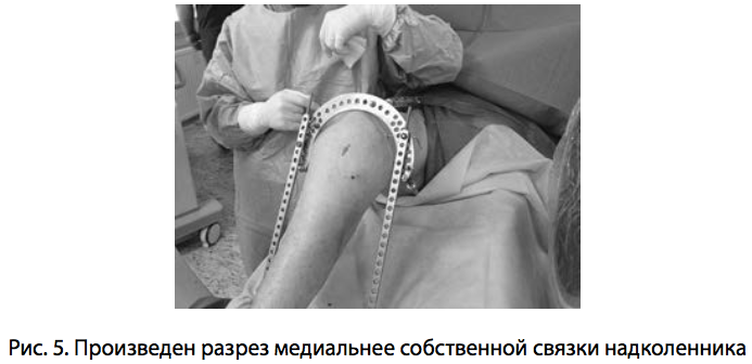 Рис. 5. Произведен разрез