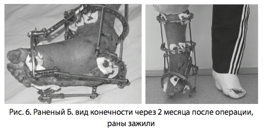 Рис. 6. Раненый Б. вид