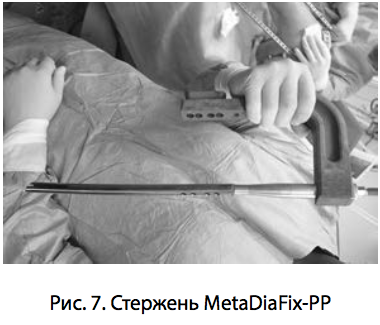 Рис. 7. Стержень MetaDiaFix-PP