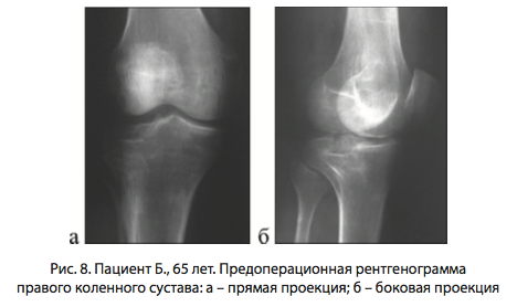 Рис. 8. Пациент Б. 65 лет