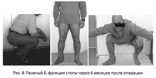 Рис. 8. Раненый Б. функция