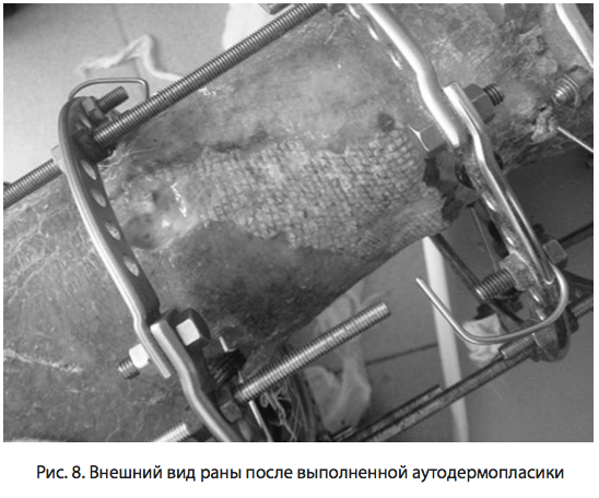 Рис. 8. Внешний вид раны после