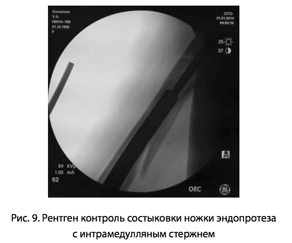 Рис. 9. Рентген контроль состыковки