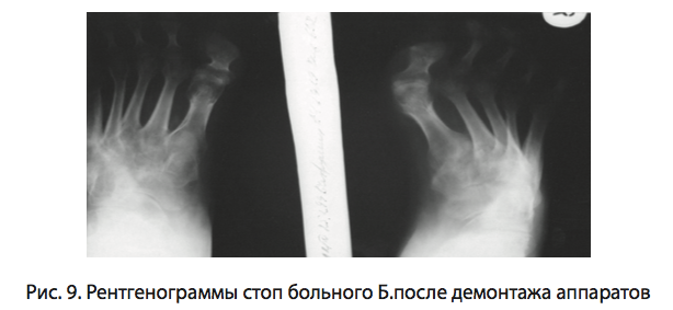Рис. 9. Рентгенограммы