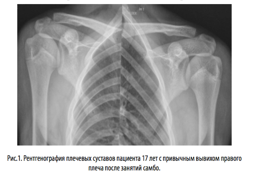 рис1