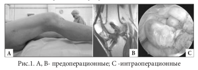 рис1