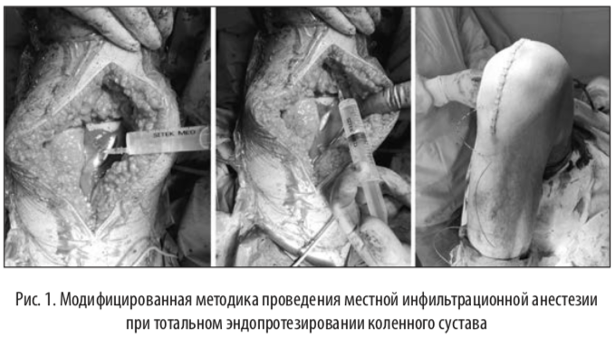 рис1
