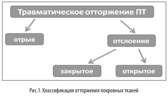рис1