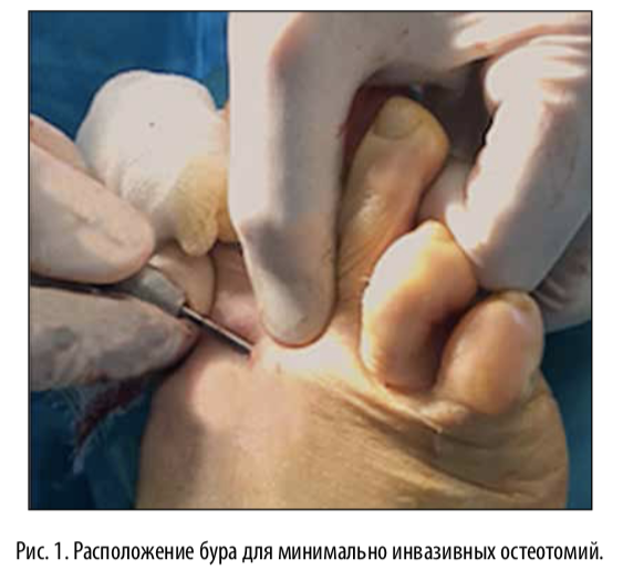 рис1
