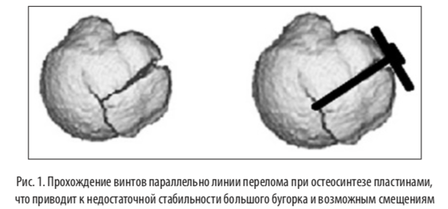 рис1