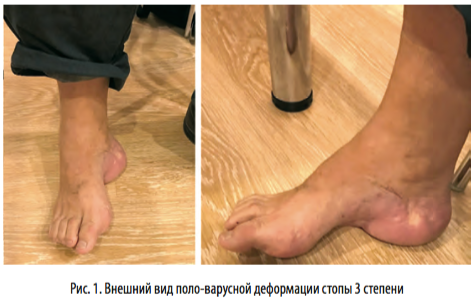 рис1