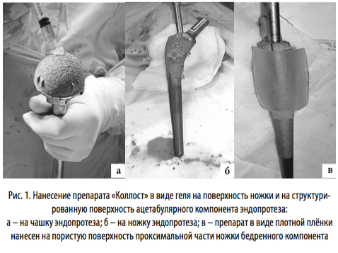 рис1