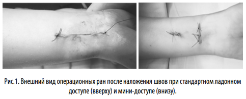 рис1