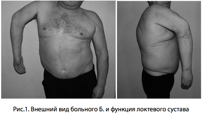 Рис.1. Внешний вид больного Б