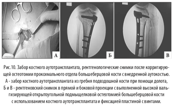 рис10