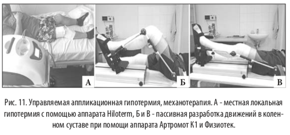 рис11