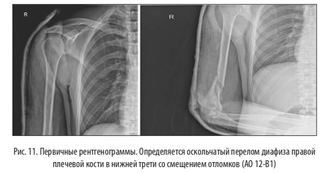 рис11