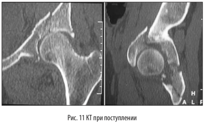 рис11