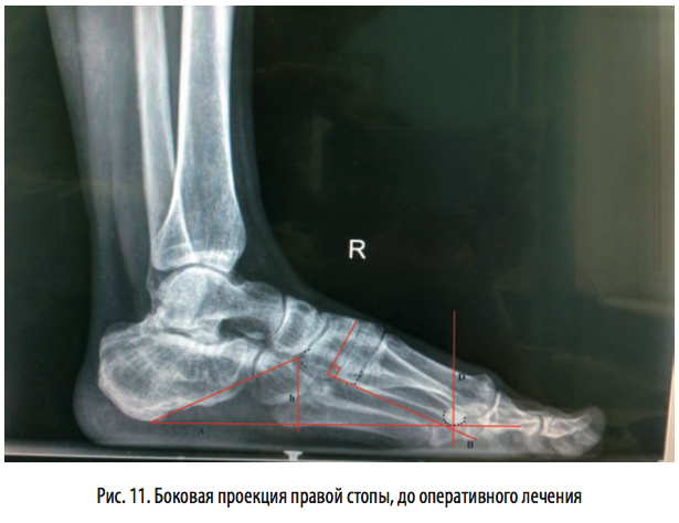 рис11