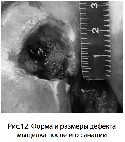 Рис.12. Форма и размеры дефекта