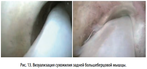 рис13