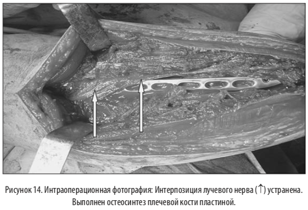 рис14