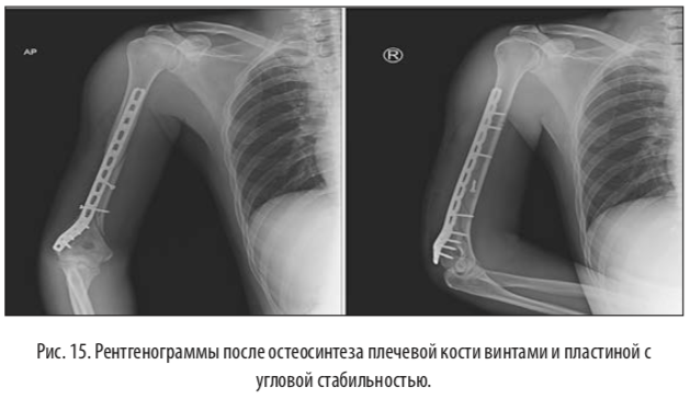 рис15