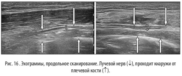 рис16