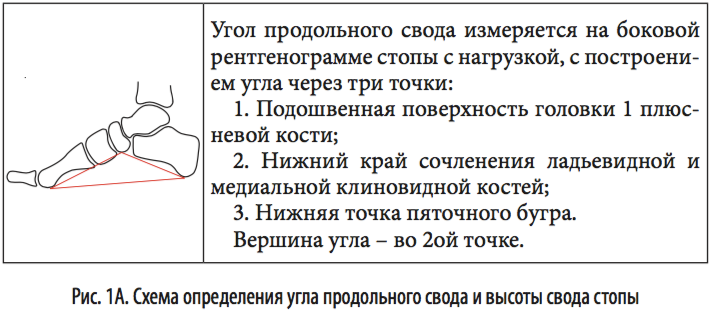 рис1а