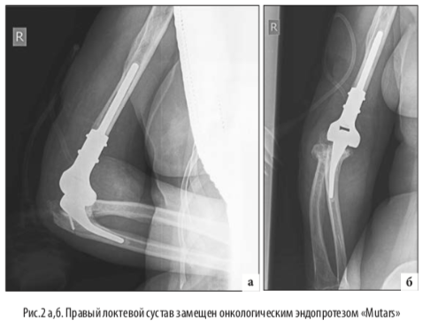 рис2