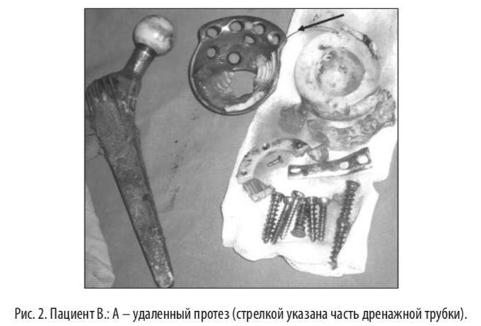 рис2