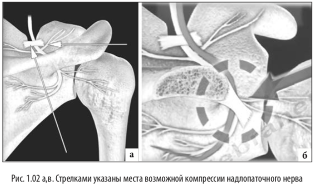 рис2